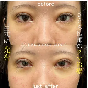 EMMO FACE CLINIC 大阪梅田院 山﨑 冴羅医師の症例