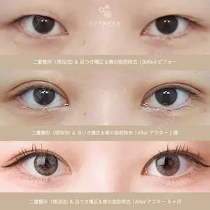 リンク美容外科 チョン・ミンス医師の症例