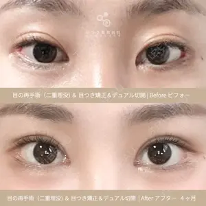 リンク美容外科 チョン・ミンス医師の症例