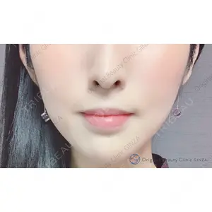 Original Beauty Clinic GINZA 佐藤玲史医師の症例