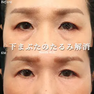 ヴェリテクリニック 大阪院 前田 珠未医師の症例