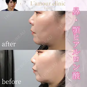 L‘amour clinic Tokyo【ラムールクリニック東京】の症例