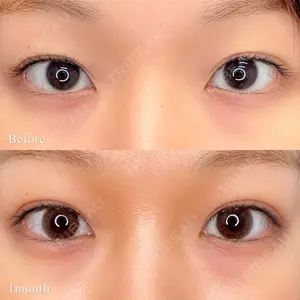 東京シンデレラ美容外科 池袋院の症例