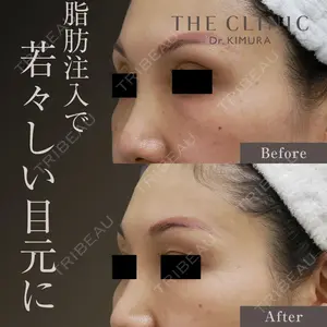 THE CLINIC（ザ・クリニック） 広島院 木村 圭吾医師の症例