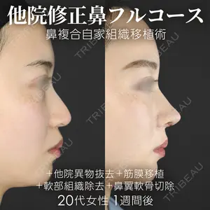 ジョウクリニック 銀座院 重本　譲医師の症例
