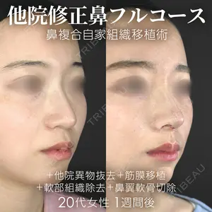 ジョウクリニック 銀座院 重本　譲医師の症例