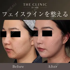 THE CLINIC（ザ・クリニック） 福岡院 安部 光洋医師の症例