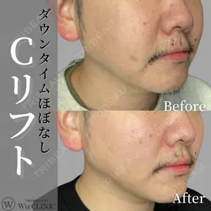 表参道ウィズ・クリニックの症例