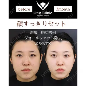 Otus Clinic 【オータスクリニック】 中 徳太郎医師の症例