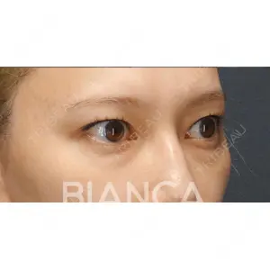 BIANCA銀座 堀田 和亮医師の症例