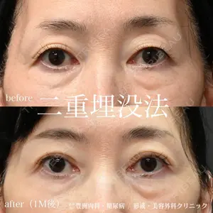 豊洲内科・糖尿病 / 形成・美容外科クリニック 澤口 悠医師の症例