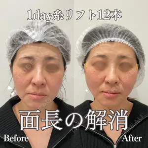 REVO CLINIC PLUS 結城 直哉医師の症例