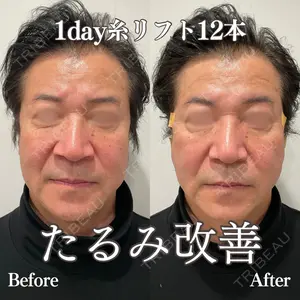 REVO CLINIC PLUS 結城 直哉医師の症例