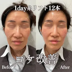 REVO CLINIC PLUS 結城 直哉医師の症例