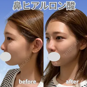 アムルーズ美容外科クリニック 横浜院の症例
