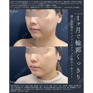 湘南美容クリニック 銀座院の症例