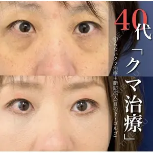 グローバルビューティークリニック 銀座院 理事長　杉崎　裕斗医師の症例