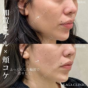 KAGA CLINIC 加賀 裕基医師の症例