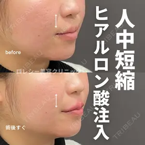 ロレシー美容クリニック 心斎橋駅前院 高田先生医師の症例