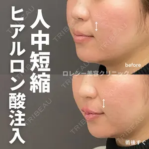 ロレシー美容クリニック 心斎橋駅前院 高田先生医師の症例