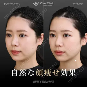 Otus Clinic 【オータスクリニック】 中 徳太郎医師の症例