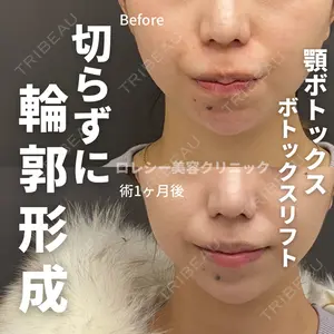 ロレシー美容クリニック 心斎橋駅前院 高田先生医師の症例