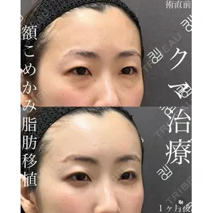 EMMO FACE CLINIC 大宮院 廣松 直樹医師の症例