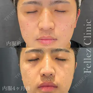 Fellez Clinic【フェルズクリニック】 小野 泰寛医師の症例