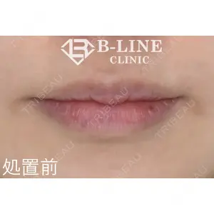 B-LINE CLINIC 池袋院 小池 康弘医師の症例