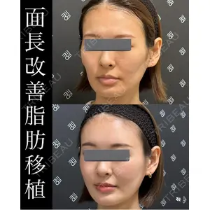 EMMO FACE CLINIC 大宮院 廣松 直樹医師の症例