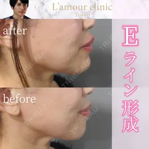 L‘amour clinic Tokyo【ラムールクリニック東京】の症例