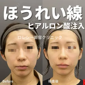 ロレシー美容クリニック 心斎橋駅前院 福留院長医師の症例