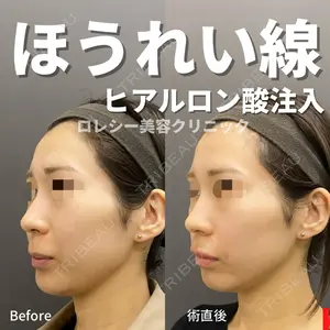 ロレシー美容クリニック 心斎橋駅前院 福留院長医師の症例