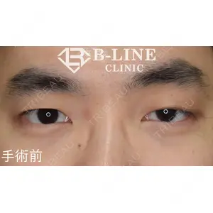 B-LINE CLINIC 池袋院 小池 康弘医師の症例