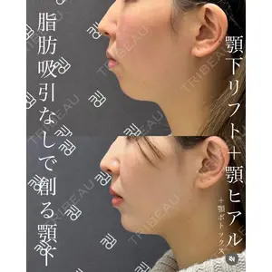 EMMO FACE CLINIC 大宮院 廣松 直樹医師の症例