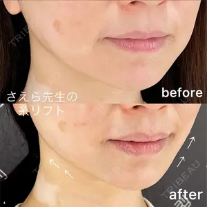 EMMO FACE CLINIC 大阪梅田院 山﨑 冴羅医師の症例