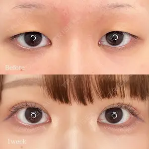 東京シンデレラ美容外科 池袋院の症例