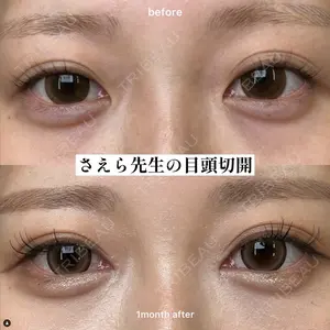 EMMO FACE CLINIC 大阪梅田院 山﨑 冴羅医師の症例