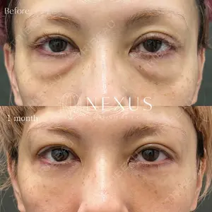 NEXUS CLINICの症例