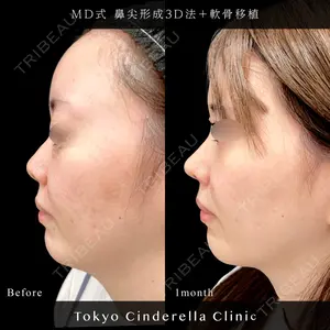 東京シンデレラ美容外科 池袋院 小出 真哉医師の症例