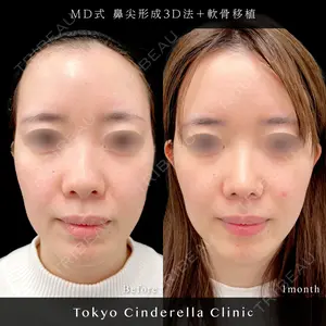 東京シンデレラ美容外科 池袋院 小出 真哉医師の症例