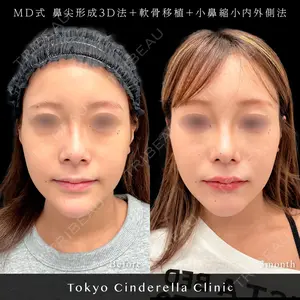 東京シンデレラ美容外科 池袋院 小出 真哉医師の症例