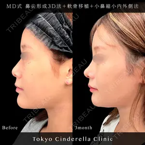 東京シンデレラ美容外科 池袋院 小出 真哉医師の症例