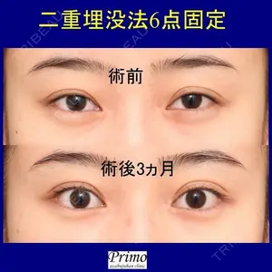 プリモ麻布十番クリニック 高橋 範夫医師の症例