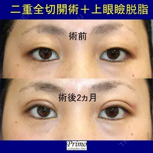 プリモ麻布十番クリニックの症例
