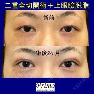 プリモ麻布十番クリニック 高橋 範夫医師の症例