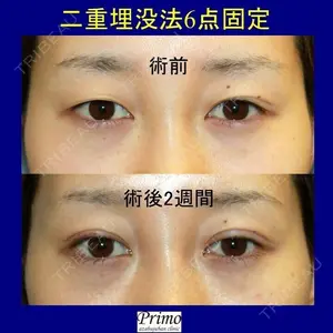 プリモ麻布十番クリニック 高橋 範夫医師の症例