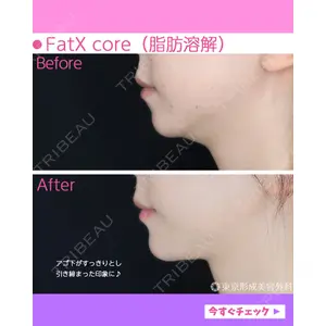 東京形成美容外科 船橋院 山崎 修吾医師の症例