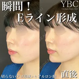 YBC横浜美容外科 大宮院 磯村 亮輔医師の症例