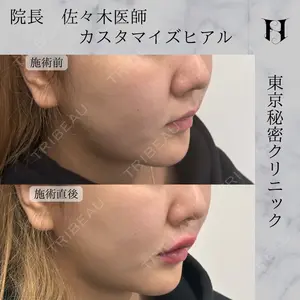 LA CLEF CLINIC（ラクレクリニック） 佐々木 健一郎医師の症例